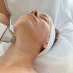 Bőrmegújulás az első kezelés után – A kezelés utáni bőrpír természetes reakció, amely néhány nap alatt regenerálódik, miközben a kollagéntermelés fokozódik.